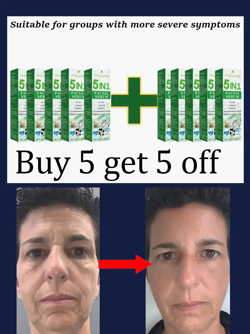 Secrets to a Youthful Appearance Qᵘⁱᶜᵏˡʸ Rᵉᵐᵒᵛᵉ Wʳⁱⁿᵏˡᵉˢ