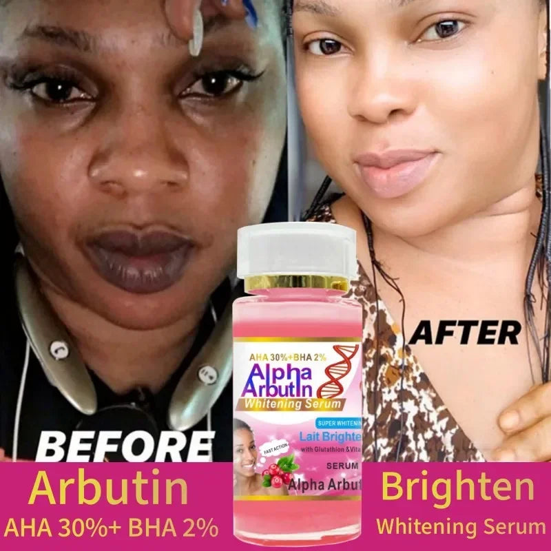 120ml SUPER AHA 30%+BHA2% Alpha Arbutin X 3 Suero facial Iluminador de leche con glutatión y vitamina C Crema
